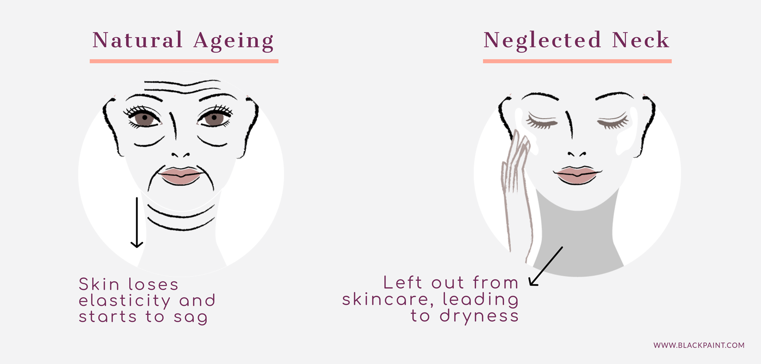 Neck wrinkles occur in natural aging process, as well s in neglected necks