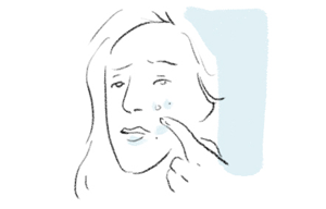 illustration of woman touching her face often causing ACNE