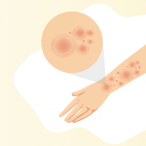 illustration of wounds and blemishes on forearm